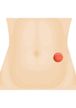 como-recolectar-material-intestinal-eii-2